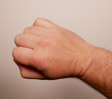 Male Right Hand (7)